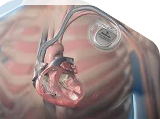 Cardiologist in Meerut